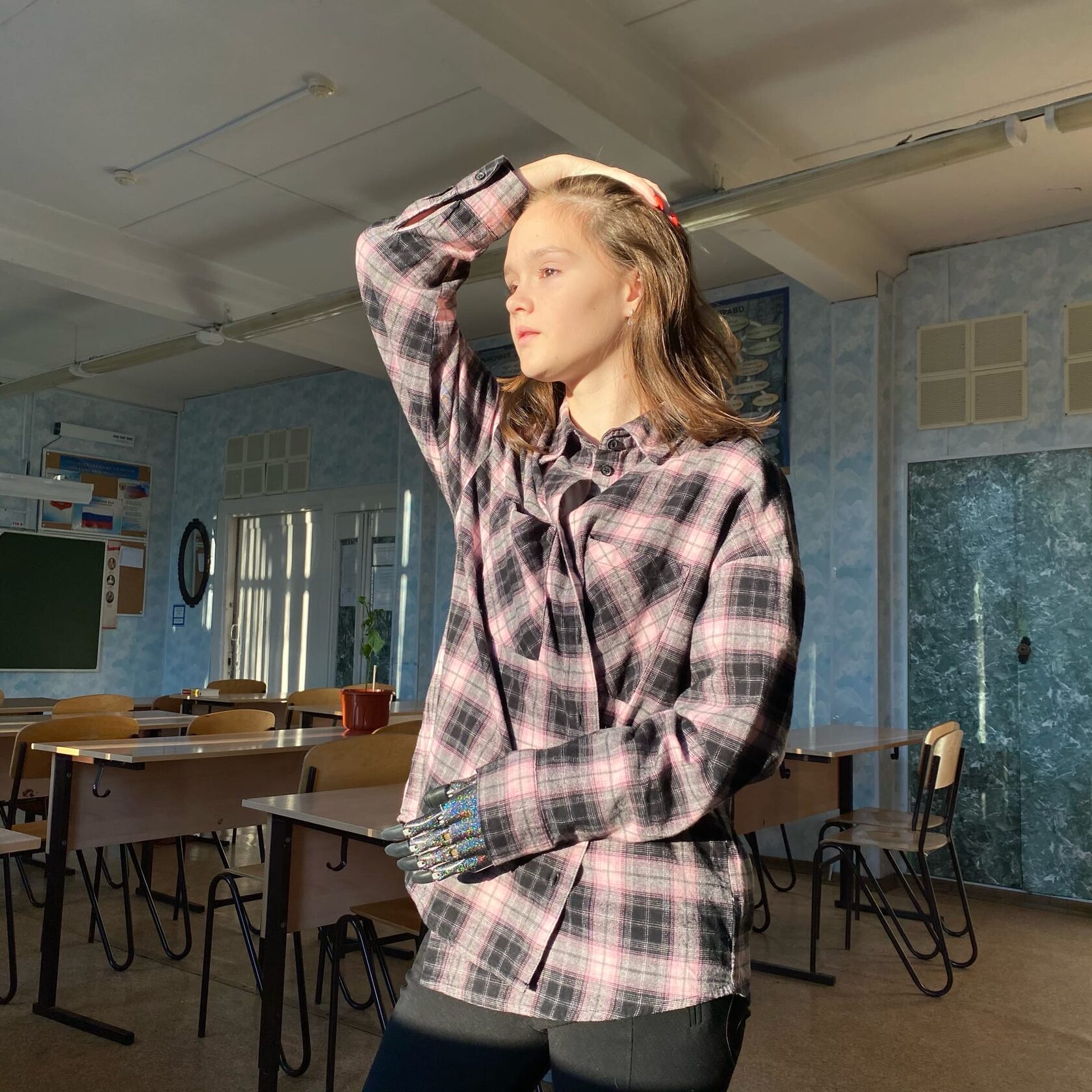 Без протеза Киби я была бы не я