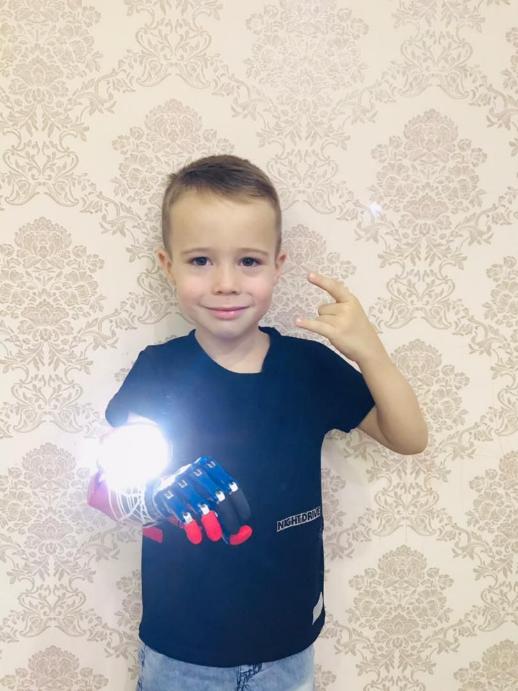 «Моторика» и Правительство Узбекистана установили кибер-руки двум мальчикам