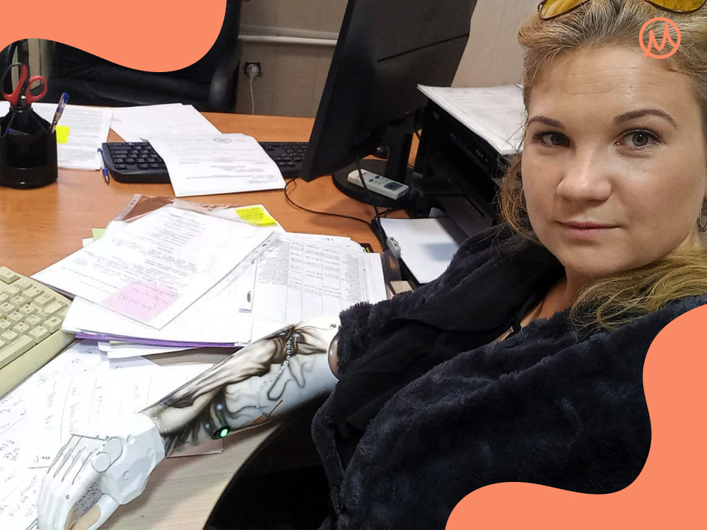 Марина с бионической рукой из Белгорода