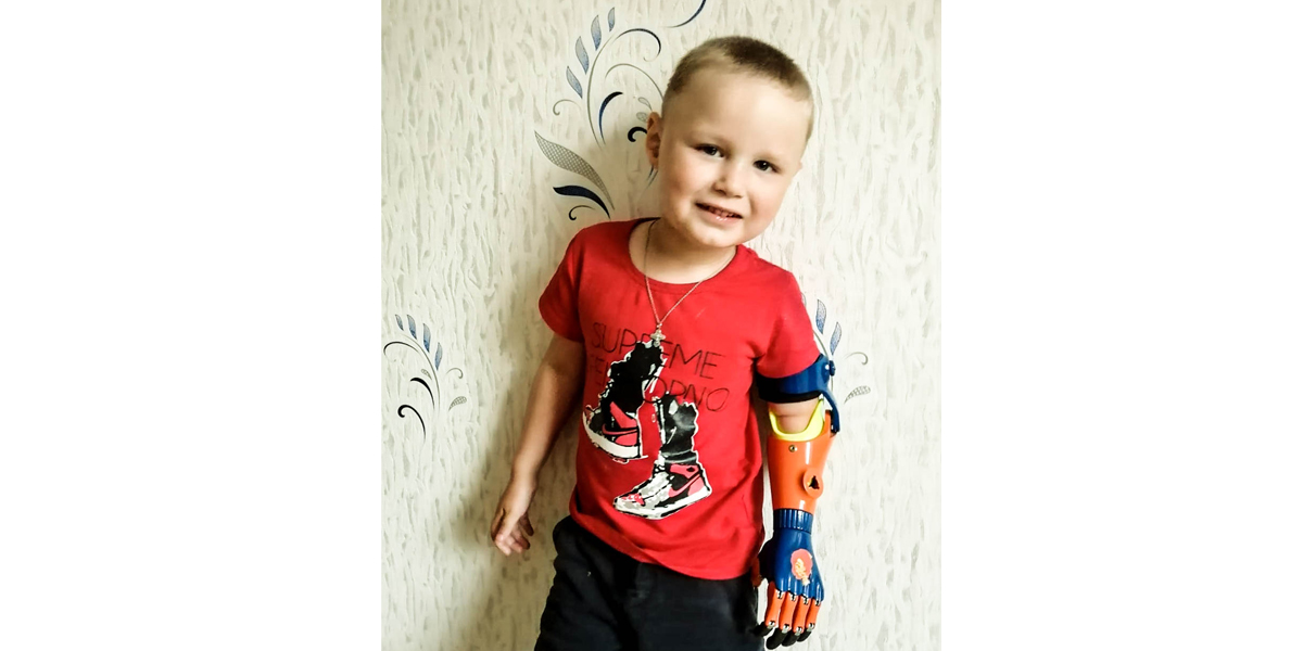 «Протез — это, во-первых, помощник ребёнка»