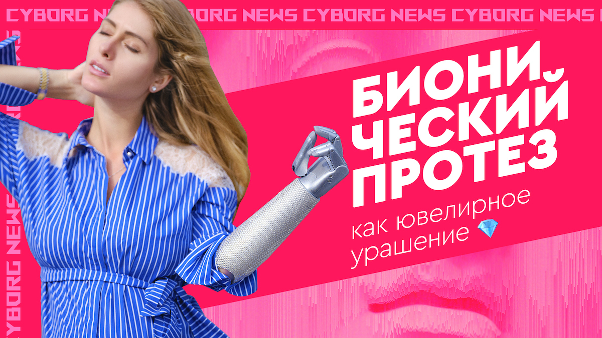 Бионический протез-украшение для Вероники