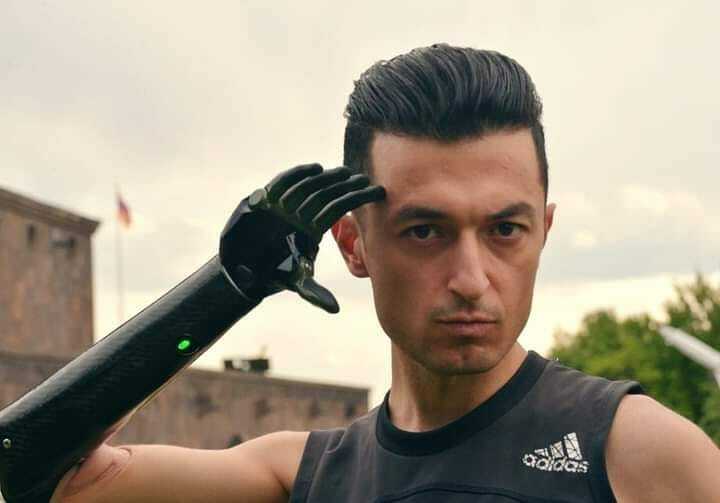 «Когда я был ребенком, не осознавал серьезность травмы»