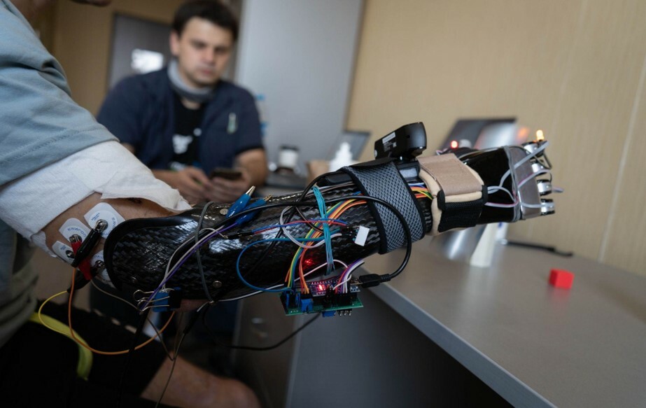 Исследования фантомных болей