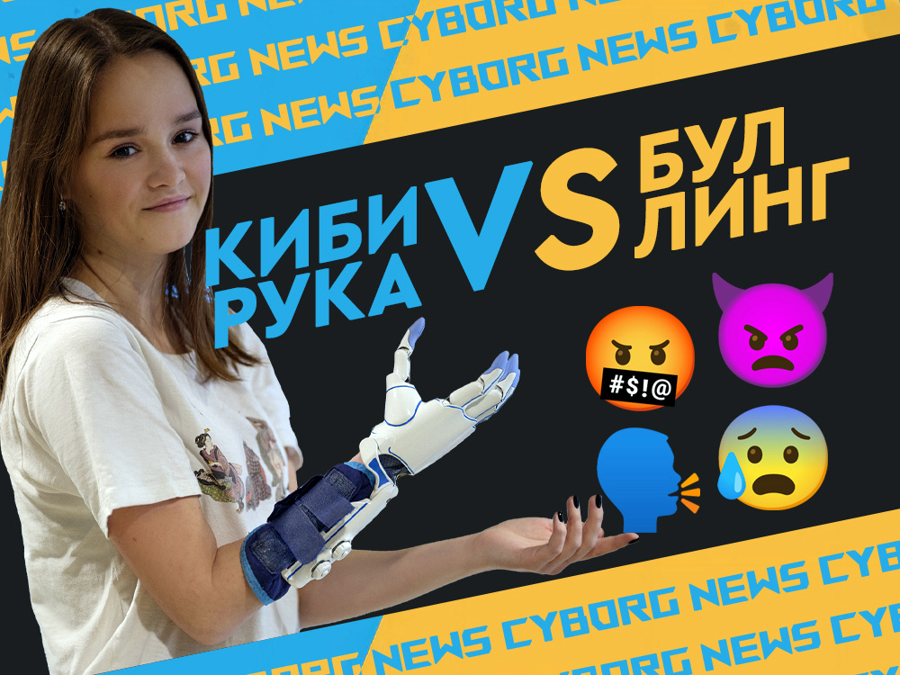 «Зачем ходить без протеза, когда можно ходить с ним?»