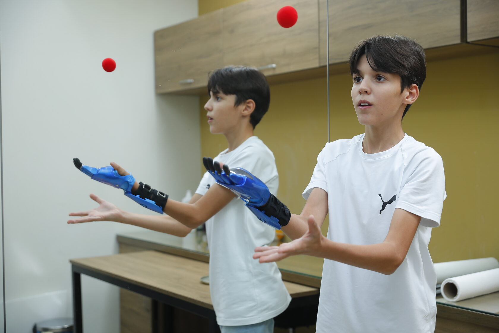 «Моторика» установила киберпротезы рук двум азербайджанским детям