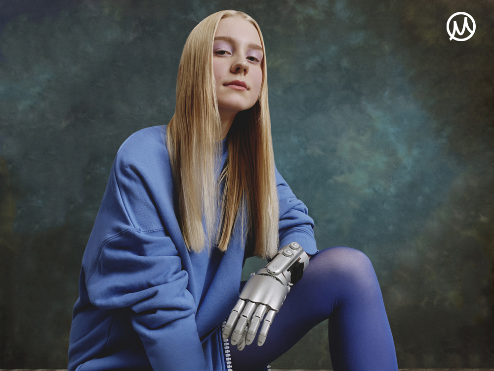 «Протез я начала носить не сразу — стеснялась»