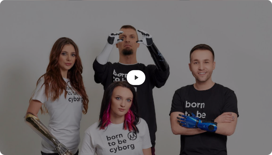 Пользователь протеза